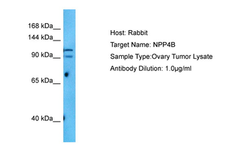 INPP4B Rabbit Polyclonal Antibody