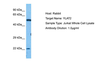 SLC7A6 Rabbit Polyclonal Antibody