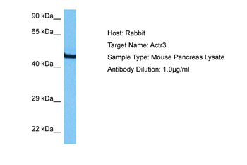 ACTR3 Rabbit Polyclonal Antibody