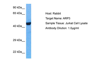 ACTR3 Rabbit Polyclonal Antibody