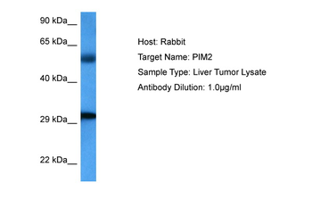 PIM2 Rabbit Polyclonal Antibody