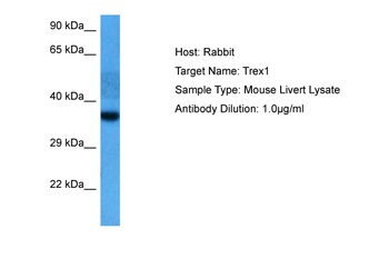 TREX1 Rabbit Polyclonal Antibody