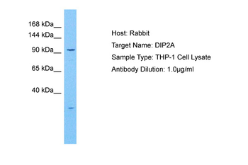 DIP2A Rabbit Polyclonal Antibody