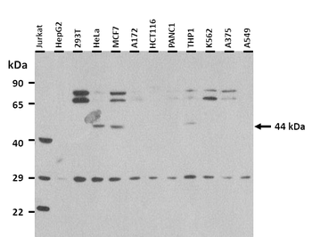 SS18L1 Rabbit Polyclonal Antibody