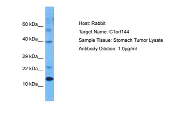 SZRD1 Rabbit Polyclonal Antibody