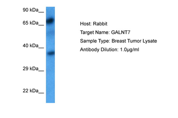 GALNT7 Rabbit Polyclonal Antibody
