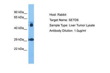 KMT5A Rabbit Polyclonal Antibody