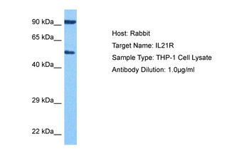 IL21R Rabbit Polyclonal Antibody