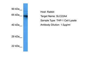 SLC22A4 Rabbit Polyclonal Antibody
