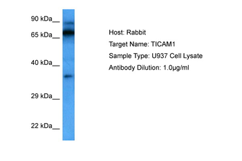 TICAM1 Rabbit Polyclonal Antibody