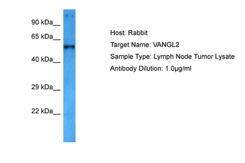 VANGL2 Rabbit Polyclonal Antibody