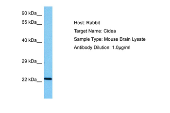 CIDEA Rabbit Polyclonal Antibody