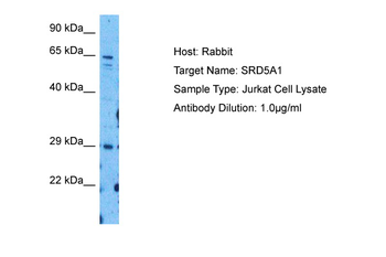 SRD5A1 Rabbit Polyclonal Antibody