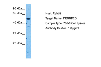 DENND2D Rabbit Polyclonal Antibody