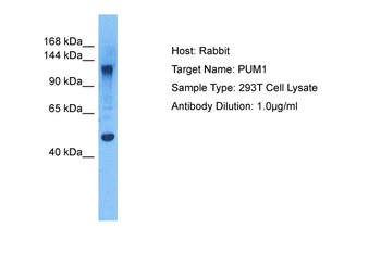 PUM1 Rabbit Polyclonal Antibody