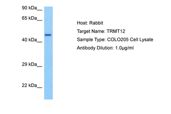 TRMT12 Rabbit Polyclonal Antibody