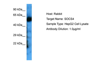 SOCS4 Rabbit Polyclonal Antibody
