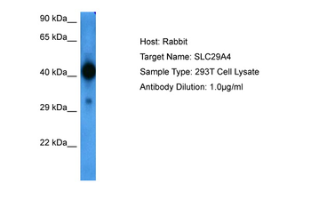 SLC29A4 Rabbit Polyclonal Antibody