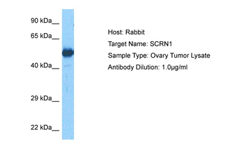 SCRN1 Rabbit Polyclonal Antibody