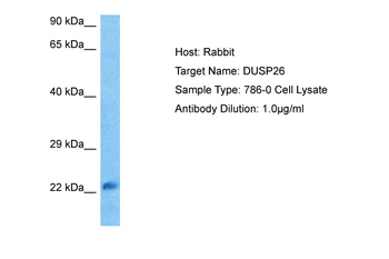DUSP26 Rabbit Polyclonal Antibody