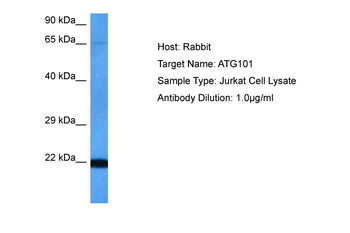 ATG101 Rabbit Polyclonal Antibody