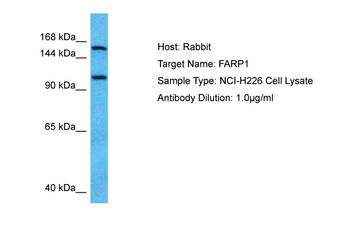 FARP1 Rabbit Polyclonal Antibody