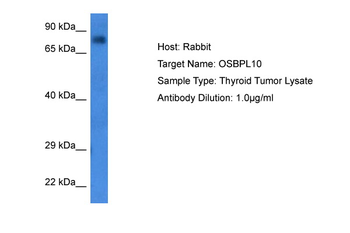 OSBPL10 Rabbit Polyclonal Antibody