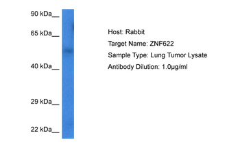 ZNF622 Rabbit Polyclonal Antibody
