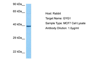 GYG1 Rabbit Polyclonal Antibody
