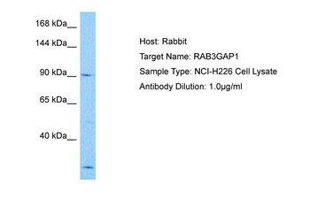 RAB3GAP1 Rabbit Polyclonal Antibody