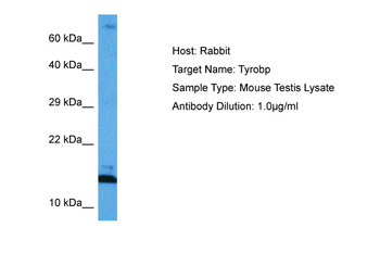 TYROBP Rabbit Polyclonal Antibody