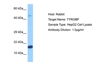 TYROBP Rabbit Polyclonal Antibody