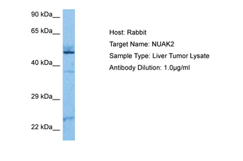NUAK2 Rabbit Polyclonal Antibody