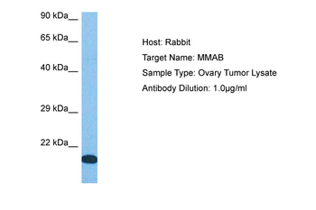 MMAB Rabbit Polyclonal Antibody