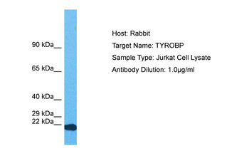 TYROBP Rabbit Polyclonal Antibody