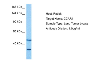 CCAR1 Rabbit Polyclonal Antibody