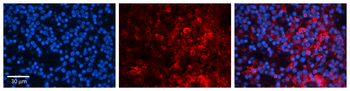 CHUK Rabbit Polyclonal Antibody