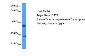 GRTP1 Rabbit Polyclonal Antibody