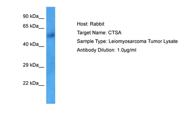 CTSA Rabbit Polyclonal Antibody