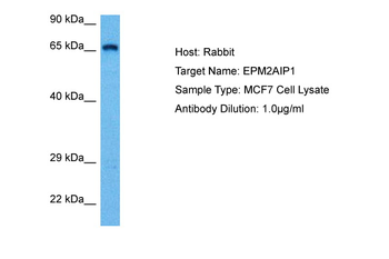 EPM2AIP1 Rabbit Polyclonal Antibody