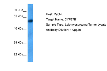 CYP27B1 Rabbit Polyclonal Antibody