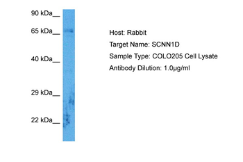 SCNN1D Rabbit Polyclonal Antibody