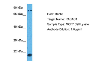 RABAC1 Rabbit Polyclonal Antibody