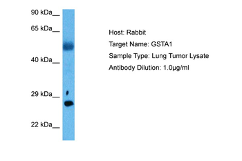 GSTA1 Rabbit Polyclonal Antibody