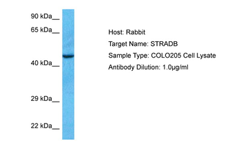 STRADB Rabbit Polyclonal Antibody
