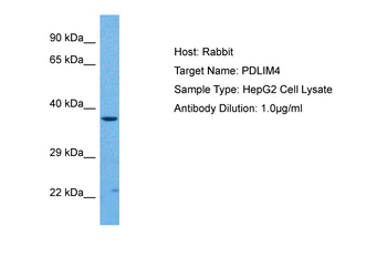 PDLIM4 Rabbit Polyclonal Antibody