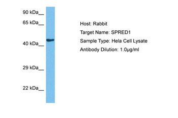 SPRED1 Rabbit Polyclonal Antibody