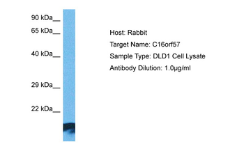 USB1 Rabbit Polyclonal Antibody