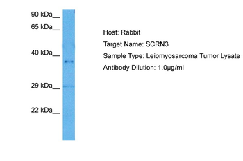 SCRN3 Rabbit Polyclonal Antibody