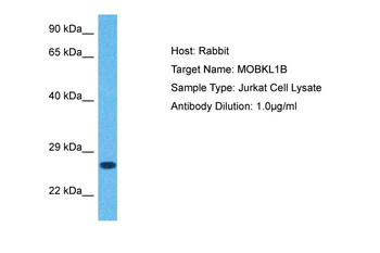 MOB1A Rabbit Polyclonal Antibody